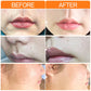 JOY-Pretty® | Zachte Ontharingscrème